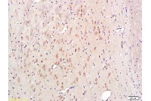 Immunohistochemistry (Paraffin-embedded Sections) (IHC (p)) image for anti-Cytochrome C, Somatic (CYCS) (AA 51-105) antibody (ABIN723590)