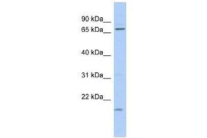 Western Blot showing FUBP3 antibody used at a concentration of 1-2 ug/ml to detect its target protein. (FUBP3 antibody  (N-Term))