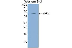 Western blot analysis of the recombinant protein. (NPPA antibody  (AA 25-152))