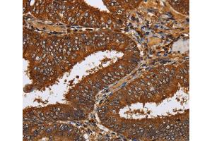 Immunohistochemistry (IHC) image for anti-Toll-Like Receptor Adaptor Molecule 2 (TICAM2) antibody (ABIN2430279) (TICAM2 antibody)