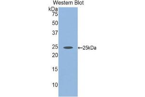 Western Blotting (WB) image for anti-Fibulin 2 (FBLN2) (AA 1013-1221) antibody (ABIN1858811) (FBLN2 antibody  (AA 1013-1221))
