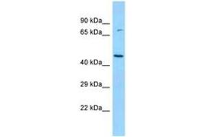 Image no. 1 for anti-Branched Chain Ketoacid Dehydrogenase Kinase (BCKDK) (N-Term) antibody (ABIN6748346) (BCKDK 抗体  (N-Term))