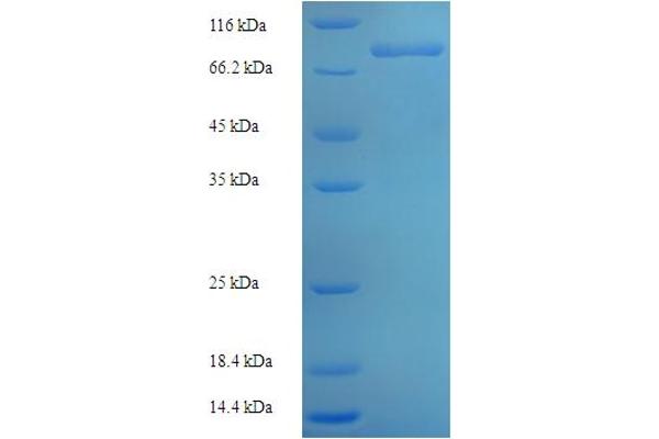 ZNF155 Protein (AA 1-538, full length) (His-SUMO Tag)