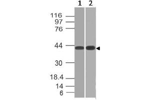Image no. 1 for anti-Cytokine Receptor-Like Factor 2 (CRLF2) (AA 97-252) antibody (ABIN5027608) (CRLF2 antibody  (AA 97-252))