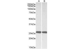 ABIN571206 (0. (UCHL1 antibody  (AA 58-68))