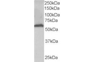 Image no. 2 for anti-Formiminotransferase Cyclodeaminase (FTCD) (N-Term) antibody (ABIN374453) (FTCD antibody  (N-Term))