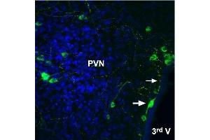 Expression of Angiotensin II receptor type-2 in rat brain - Immunohistochemical staining of rat frozen free floating brain sections using Anti-Angiotensin II Receptor Type-2 (extracellular)-ATTO Fluor-488 Antibody (ABIN7042926), (1:20). (Angiotensin II Type 2 Receptor antibody  (Extracellular, N-Term) (Atto 488))