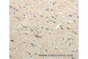 Immunohistochemistry of Human brain using SIRT3 Polyclonal Antibody at dilution of 1:30 (SIRT3 antibody)