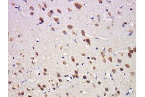 Paraformaldehyde-fixed, paraffin embedded rat brain tissue, Antigen retrieval by boiling in sodium citrate buffer(pH6) for 15min, Block endogenous peroxidase by 3% hydrogen peroxide for 30 minutes, Blocking buffer (normal goat serum) at 37°C for 20min, Antibody incubation with Rabbit Anti-OPRD1 (Ser363) Polyclonal Antibody, Unconjugated  at 1:500 overnight at 4°C, followed by a conjugated secondary and DAB staining (OPRD1 antibody  (pSer363))