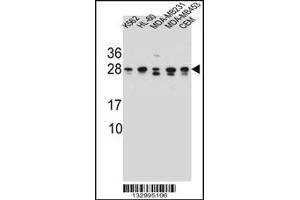 Western blot analysis in K562,HL-60,MDA-MB231,MDA-MB453,CEM cell line lysates (35ug/lane). (RAB3D antibody  (C-Term))