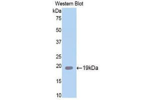 Western Blotting (WB) image for anti-serpin Peptidase Inhibitor, Clade A (Alpha-1 Antiproteinase, Antitrypsin), Member 6 (SERPINA6) (AA 106-255) antibody (ABIN1858273) (SERPINA6 antibody  (AA 106-255))