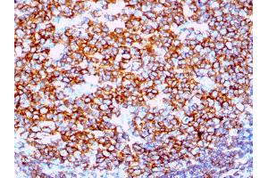 Formalin-fixed, paraffin-embedded human Tonsil stained with CD20 Rabbit Recombinant Monoclonal Antibody (IGEL/1497R). (Recombinant CD20 antibody)