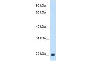 KLK-B1 antibody used at 2. (KLK-B1 antibody)