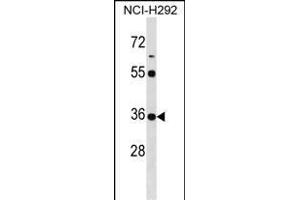 KCTD17 Antibody (Center) (ABIN1537742 and ABIN2850368) western blot analysis in NCI- cell line lysates (35 μg/lane). (KCTD17 antibody  (AA 107-136))