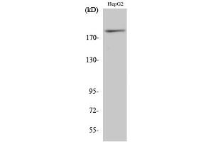 Western Blotting (WB) image for anti-Insulin Receptor Substrate 1 (IRS1) (pSer312) antibody (ABIN5956971) (IRS1 antibody  (pSer312))