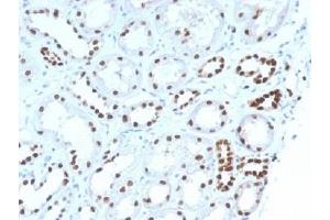 Immunohistochemistry (IHC) image for anti-Paired Box 8 (PAX8) (AA 60-261) antibody (ABIN4949848)