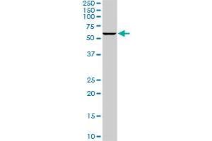 PLK1 monoclonal antibody (M04), clone 4G11. (PLK1 antibody  (AA 1-603))