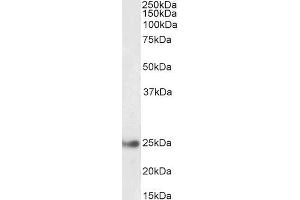 ABIN5539848 (0. (GSTA4 antibody  (Internal Region))