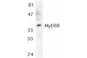 Image no. 1 for anti-Myeloid Differentiation Primary Response Gene (88) (MYD88) (AA 279-296) antibody (ABIN202374) (MYD88 antibody  (AA 279-296))