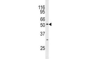 Western blot analysis of JNK3 antibody and mouse brain tissue lysate. (MAPK10 antibody  (AA 1-30))