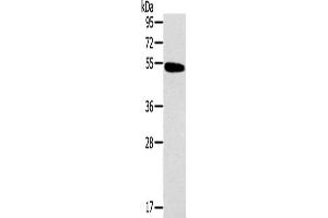 Western Blotting (WB) image for anti-Histamine Receptor H1 (HRH1) antibody (ABIN2434780) (HRH1 antibody)