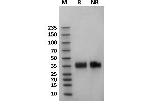 Human Fc gamma RIIa / CD32a (167H) protein on Coomassie Blue stained SDS-PAGE under non-reducing (NR) and reducing (R) conditions. (FCGR2A Protein (AA 36-218) (His-Avi Tag))