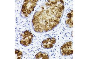 Immunohistochemistry of paraffin-embedded human colon using TFF3 Rabbit mAb (ABIN1680916, ABIN3019077, ABIN3019078 and ABIN7101711) at dilution of 1:100 (40x lens). (TFF3 antibody)