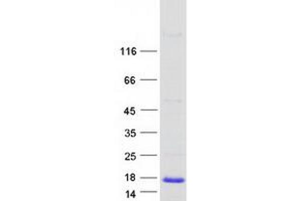 Microseminoprotein, Prostate Associated (MSMP) protein (Myc-DYKDDDDK Tag)