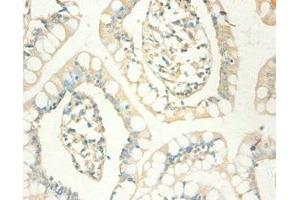 Immunohistochemistry of paraffin-embedded human small intestine tissue using ABIN7159537 at dilution of 1:100 (MT1X antibody  (AA 1-59))