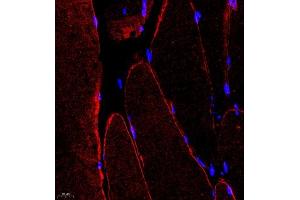 Immunofluorescence of paraffin embedded rat Skeletal muscle using DMD (ABIN7073791) at dilution of 1:650 (400x lens) (Dystrophin antibody)