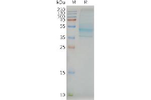 CCR7 Protein