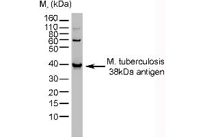 M. tuberculosis antibody