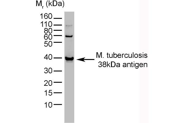 M. tuberculosis antibody