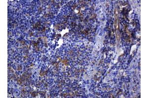 Immunohistochemistry (IHC) image for anti-Sterol O-Acyltransferase 2 (SOAT2) (AA 1-120) antibody (ABIN2715640) (SOAT2 antibody  (AA 1-120))