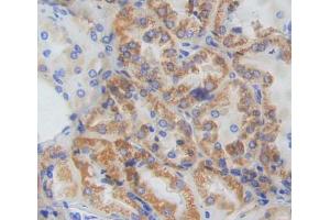 Used in DAB staining on fromalin fixed paraffin- embedded kidney tissue (CISH antibody  (AA 1-258))