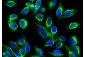 Immunofluorescence analysis of Hela cell. (Vimentin antibody  (Ser56))