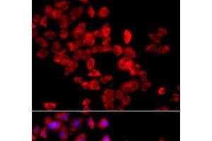 Immunofluorescence analysis of A549 cells using EIF4G1 Polyclonal Antibody (EIF4G1 antibody)