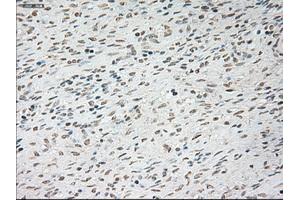 Immunohistochemical staining of paraffin-embedded Ovary tissue using anti-TNNI3mouse monoclonal antibody. (TNNI3 antibody  (AA 1-210))