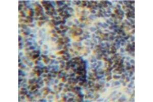 IHC-P analysis of Spleen tissue, with DAB staining. (BID antibody  (AA 1-195))