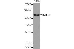 Western Blotting (WB) image for anti-NLR Family, Pyrin Domain Containing 3 (NLRP3) antibody (ABIN1876853) (NLRP3 antibody)