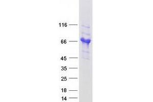 Validation with Western Blot (GOLM1 Protein (Transcript Variant 1) (Myc-DYKDDDDK Tag))