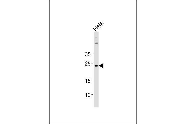 BLOC1S4抗体（AA 114-143）