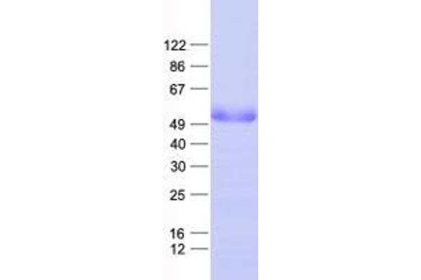 ZNF101 Protein (His tag)