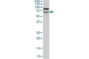 Western Blotting (WB) image for anti-Nucleolar and Coiled-Body Phosphoprotein 1 (NOLC1) (AA 590-700) antibody (ABIN598599) (NOLC1 antibody  (AA 590-700))