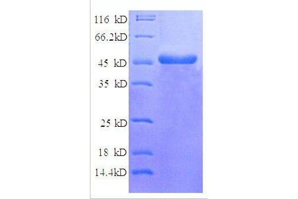 NDUFV2 Protein (AA 35-249, partial) (GST tag)