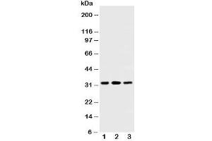 Western blot testing of SDHB antibody and Lane 1:  rat testis;  2: rat heart;  3: Jurkat cell lysate. (SDHB antibody  (AA 42-59))