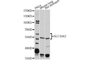 Western blot analysis of extracts of various cell lines, using SLC18A2 antibody. (SLC18A2 antibody)