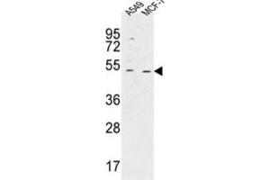 Western Blotting (WB) image for anti-HAUS Augmin-Like Complex, Subunit 4 (HAUS4) antibody (ABIN3002271) (C14orf94 antibody)