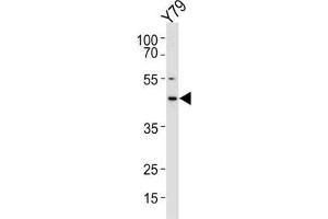 Western Blotting (WB) image for anti-Retinol Dehydrogenase 10 (All-Trans) (RDH10) antibody (ABIN3002122) (RDH10 antibody)