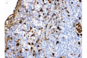 Immunohistochemistry (Paraffin-embedded Sections) (IHC (p)) image for anti-S100 Calcium Binding Protein A9 (S100A9) (AA 2-114) antibody (ABIN3043321) (S100A9 antibody  (AA 2-114))